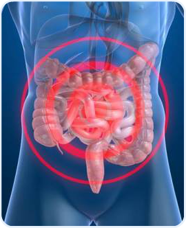 cirugia oclusion intestinal cancun